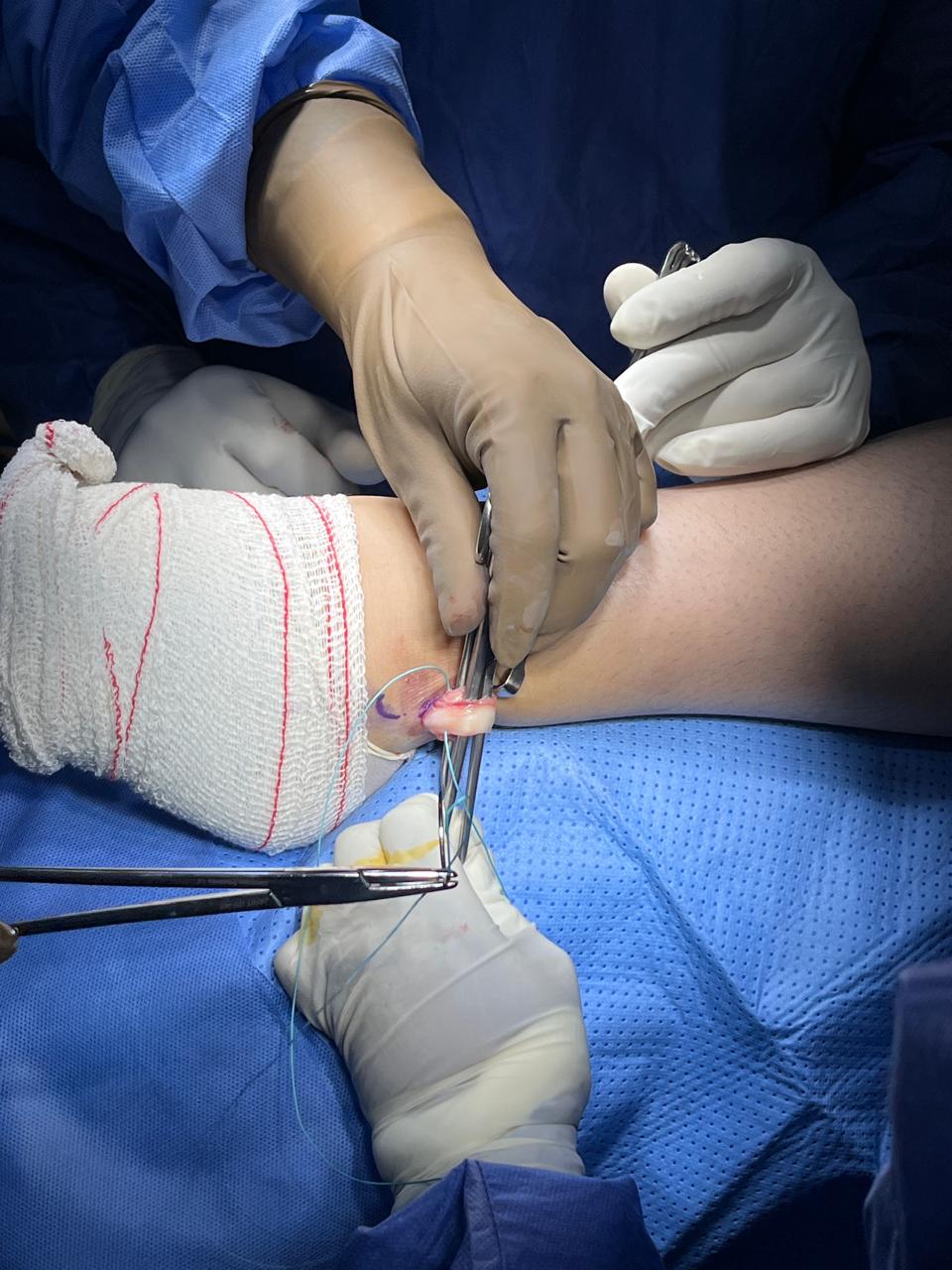 Best-doctor-for-knee-surgery