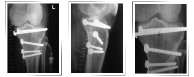 Best-orthopedic-surgeon-in-Dubai