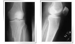 Best-orthopedic-surgeon-in-Dubai