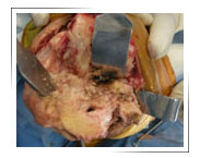 Sports-injury-clinic-Dubai