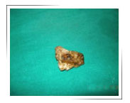 Sports-injury-clinic-Dubai