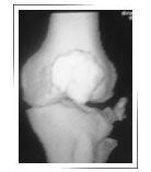 Best-orthopedic-surgeon-in-Dubai