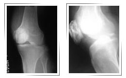 Best-orthopedic-surgeon-in-Dubai