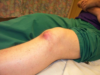 Best-shoulder-surgeon-in-Dubai