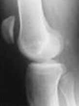 Best-dr-for-knee-replacement