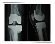 Sports-injury-clinic-Dubai